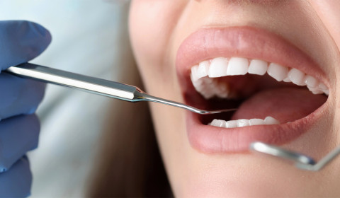 Retração Gengival: O que é e como tratar?