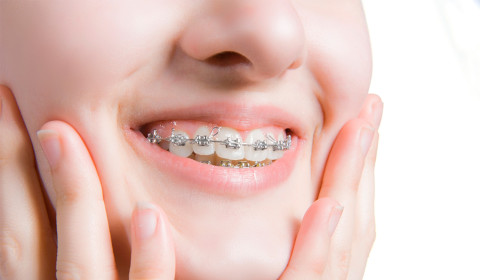 Saiba como aliviar o desconforto causado pelo aparelho dentário