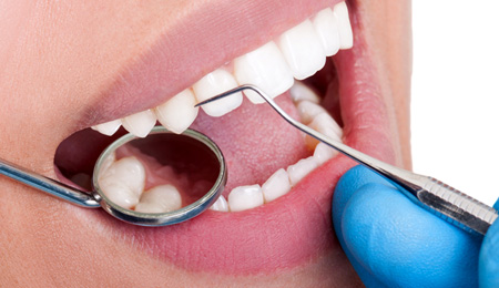 slide-branqueamento-dentario.jpg